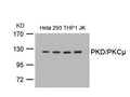 Western blot analysis of extracts from Hela, 293, THP1 and JK cells using PKD/PKCm(Ab-738) Antibody.