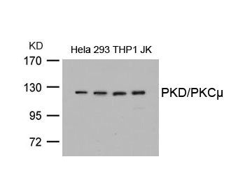 Western blot analysis of extracts from Hela, 293, THP1 and JK cells using PKD/PKCm(Ab-738) Antibody.
