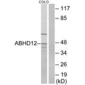 Western blot analysis of extracts from COLO cells, using ABHD12 antibody.