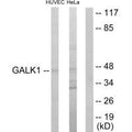 Western blot analysis of extracts from HUVEC cells and HeLa cells, using GALK1 antibody.