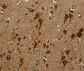 Immunohistochemical analysis of paraffin-embedded Human brain tissue using at dilution 1/40.