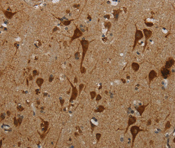 Immunohistochemical analysis of paraffin-embedded Human brain tissue using at dilution 1/40.
