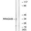 Western blot analysis of extracts from HepG2 cells, using RRAGA/B antibody.