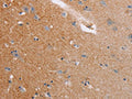 The image on the left is immunohistochemistry of paraffin-embedded Human brain tissue using CSB-PA590757(CASC3 Antibody) at dilution 1/20, on the right is treated with fusion protein. (Original magnification: ×200)
