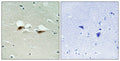 Immunohistochemical analysis of paraffin-embedded human brain tissue using ATF-2 (Phospho-Ser472) antibody (left)or the same antibody preincubated with blocking peptide (right).