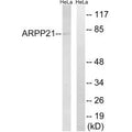 Western blot analysis of extracts from HeLa cells, using ARPP21 antibody.