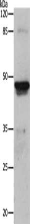 Gel: 10%SDS-PAGE, Lysate: 24 ug, Lane: Human ovarian cancer tissue, Primary antibody: CSB-PA591463(KRT15 Antibody) at dilution 1/300, Secondary antibody: Goat anti rabbit IgG at 1/8000 dilution, Exposure time: 1 minute