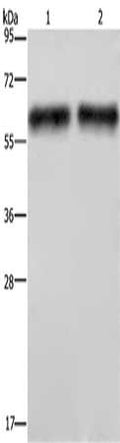 Gel: 10%SDS-PAGE, Lysate: 40 µg, 60 µg, Lane: Human hepatocellular carcinoma tissue, Primary antibody: CSB-PA591479(ELN Antibody) at dilution 1/400, Secondary antibody: Goat anti rabbit IgG at 1/8000 dilution, Exposure time: 2 minutes
