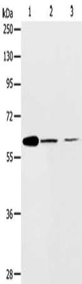 Gel: 10%SDS-PAGE, Lysate: 40 ug, Lane 1-3: NIH/3T3 cells, SKOV3 cells, human ovarian cancer tissue, Primary antibody: CSB-PA591967(ABCE1 Antibody) at dilution 1/450, Secondary antibody: Goat anti rabbit IgG at 1/8000 dilution, Exposure time: 2 minutes