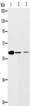 Gel: 10%SDS-PAGE, Lysate: 40 ug, Lane 1-3: NIH/3T3 cells, SKOV3 cells, human ovarian cancer tissue, Primary antibody: CSB-PA591967(ABCE1 Antibody) at dilution 1/450, Secondary antibody: Goat anti rabbit IgG at 1/8000 dilution, Exposure time: 2 minutes