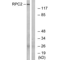 Western blot analysis of extracts from LOVO cells, using RPC2 antibody.