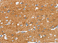 The image on the left is immunohistochemistry of paraffin-embedded Human brain tissue using CSB-PA592134(SNCA Antibody) at dilution 1/30, on the right is treated with synthetic peptide. (Original magnification: ×200)