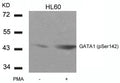 Western blot analysis of extracts from HL60 cells untreated or treated with PMA using GATA1(Phospho-Ser142) Antibody.