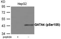 Western blot analysis of extracts from HepG2 cells using GATA4 (Phospho-Ser105) Antibody.The lane on the left is treated with the antigen-specific peptide.