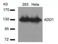 Western blot analysis of extracts from 293 and Hela cells using ADD1(Ab-726) Antibody.