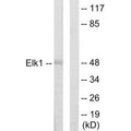 Western blot analysis of extracts from HeLa cells, using Elk1 antibody.