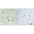 Immunohistochemistry analysis of paraffin-embedded human brain tissue using PKC θ antibody.
