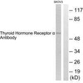 Western blot analysis of extracts from SKOV3 cells, using Thyroid Hormone Receptor α antibody.