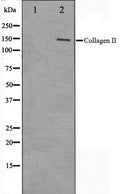 Western blot analysis on COLO205 cell lysate using Collagen II Antibody