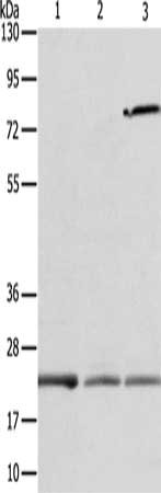 Gel: 12+15%SDS-PAGE, Lysate: 40 ug, Lane 1-3: Human fetal liver tissue, Human liver cancer tissue, human placenta tissue, Primary antibody: CSB-PA593648(APOM Antibody) at dilution 1/300, Secondary antibody: Goat anti rabbit IgG at 1/8000 dilution, Exposure time: 1 minute