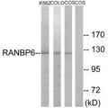Western blot analysis of extracts from K562 cells, COLO cells and COS-7 cells, using RANBP6 antibody.