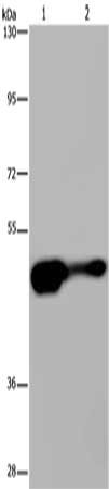 Gel: 6%SDS-PAGE, Lysate: 40 ug, Lane 1-2: Mouse liver tissue, HepG2 cells, Primary antibody: CSB-PA594525(AHRR Antibody) at dilution 1/430, Secondary antibody: Goat anti rabbit IgG at 1/8000 dilution, Exposure time: 2 minutes