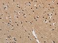 The image is immunohistochemistry of paraffin-embedded Human brain tissue using CSB-PA595538(CENPN Antibody) at dilution 1/70. (Original magnification: ×200)