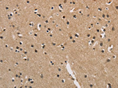 The image is immunohistochemistry of paraffin-embedded Human brain tissue using CSB-PA595538(CENPN Antibody) at dilution 1/70. (Original magnification: ×200)