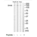 Western blot analysis of extracts from HeLa cells, Jurkat cells and HepG2 cells, using DHX8 antibody.