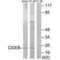 Western blot analysis of extracts from RAW264.7 cells and HT-29 cells, using CIDEB antibody.