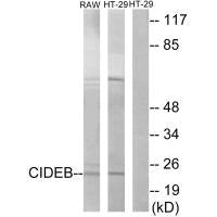 Western blot analysis of extracts from RAW264.7 cells and HT-29 cells, using CIDEB antibody.