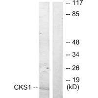 Western blot analysis of extracts from Jurkat cells, treated with serum (20%, 15mins), using CKS1 antibody.