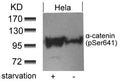Western blot analysis of extracts from Hela cells untreated or treated with starvation using a-catenin(Phospho-Ser641) antibody.