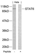 Western blot analysis of extracts from Hela cells using STAT6(Ab-645) Antibody and the same antibody preincubated with blocking peptide.