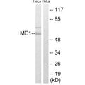 Western blot analysis of extracts from HeLa cells, using ME1 antibody.