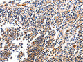 The image on the left is immunohistochemistry of paraffin-embedded Human tonsil tissue using CSB-PA597282(BCL2L15 Antibody) at dilution 1/50, on the right is treated with fusion protein. (Original magnification: ×200)