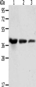 Gel: 10%SDS-PAGE, Lysate: 40 ug, Lane 1-3: A431 cells, Hela cells, Raji cells, Primary antibody: CSB-PA597516(ANXA1 Antibody) at dilution 1/450, Secondary antibody: Goat anti rabbit IgG at 1/8000 dilution, Exposure time: 20 seconds
