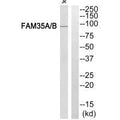 Western blot analysis of extracts from Jurkat cells, using FAM35A/B antibody.