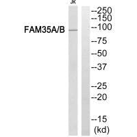 Western blot analysis of extracts from Jurkat cells, using FAM35A/B antibody.
