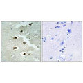 Immunohistochemistry analysis of paraffin-embedded human brain tissue using CDCA4 antibody.