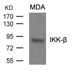 IKBKB (Ab-199) Antibody – Figure 1 of 2