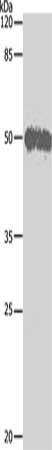 Gel: 10%SDS-PAGE, Lysate: 20 ug, Lane: Hela cells, Primary antibody: CSB-PA598474(BAG5 Antibody) at dilution 1/500, Secondary antibody: Goat anti rabbit IgG at 1/8000 dilution, Exposure time: 1 minute