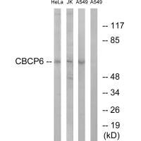 Western blot analysis of extracts from HeLa cells, Jurkat cells and A549 cells, using CBCP6 antibody.