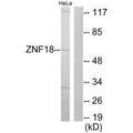 Western blot analysis of extracts from HeLa cells, using ZNF18 antibody.