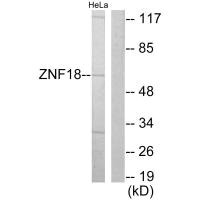 Western blot analysis of extracts from HeLa cells, using ZNF18 antibody.