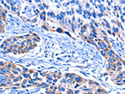 CNGA2 Antibody – Figure 1 of 2