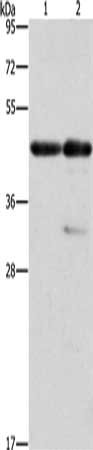 Gel: 10%SDS-PAGE, Lysate: 40 ug, Lane 1-2: Mouse heart tissue, Mouse muscle tissue, Primary antibody: CSB-PA599271(ACTA1 Antibody) at dilution 1/275, Secondary antibody: Goat anti rabbit IgG at 1/8000 dilution, Exposure time: 10 seconds
