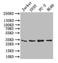 Western Blot
Positive WB detected in: JK whole cell lysate,SY5Y whole cell lysate,PC-3 whole cell lysate,,HL60 whole cell lysate
All lanes: UCP1 antibody at 1:1000
Secondary
Goat polyclonal to rabbit IgG at 1/50000 dilution
Predicted band size: 33 kDa
Observed band size: 33 kDa
