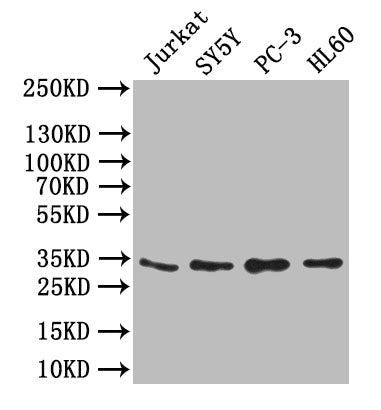 Western Blot
Positive WB detected in: JK whole cell lysate,SY5Y whole cell lysate,PC-3 whole cell lysate,,HL60 whole cell lysate
All lanes: UCP1 antibody at 1:1000
Secondary
Goat polyclonal to rabbit IgG at 1/50000 dilution
Predicted band size: 33 kDa
Observed band size: 33 kDa