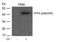 Western blot analysis of extracts from Hela cells untreated or treated with UV using ATF4(Phospho-Ser245) Antibody.